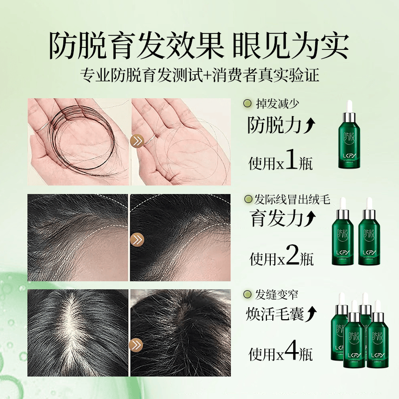 2025生发排行榜10强-生发十大产品排行榜2025年排名前十名榜单出炉